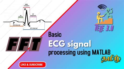 ecg signal processing